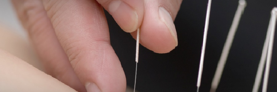 Dry-needling