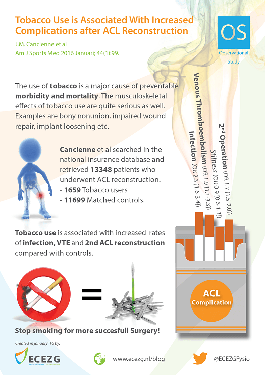 Infographic created in January 2016 by ECEZG about "Tobacco Use is Associated With Increased Complications After Anterior Cruciate Ligament Reconstruction " by Cancienne et al (2016)